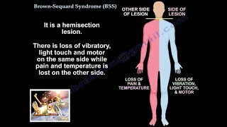 Imaging CNS autoimmune and inflammatory disease  6  Vascular [upl. by Nawram261]