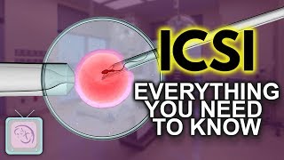 IVF ICSI Procedure  Important things you need to know [upl. by Ahsema]