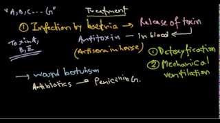 Clostridium botulinum treatment [upl. by Notnroht813]