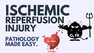 Ischemic Reperfusion Injury Pathology  Explained Simply 2024 [upl. by Maybelle]