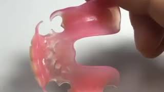 Valplast Flexible Denture [upl. by Hildebrandt]