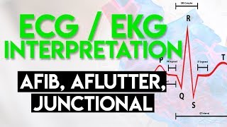 Afib Aflutter Junctional Arrhythmias  ECG EKG Interpretation Part 4 [upl. by Lehcnom]