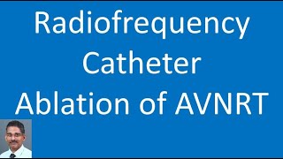 Radiofrequency Catheter Ablation of AVNRT [upl. by Nahsad]