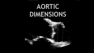 Aortic Stenosis  Heart Sounds  MEDZCOOL [upl. by Themis]