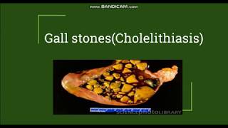 Cholelithiasis  Gallstones Pathogenesis amp Morphology [upl. by Arnelle169]