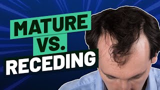 Mature Hairline Versus Receding Hairline  How To Tell The Difference [upl. by Anaert]