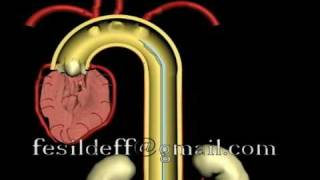 IABP Intraaortic Ballon Pump [upl. by Niltag]