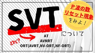 【心電図】SVT総論 AT AVNRT ORT AVRT NVORT NFORT [upl. by Alenson162]