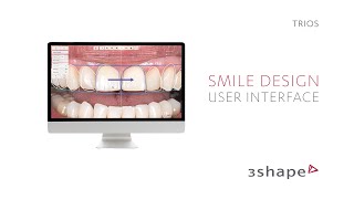 3Shape  Smile Design User Interface [upl. by Senaj427]