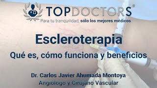 ¿Sabías que la escleroterapia es la mejor opción para las várices [upl. by Raffaj929]