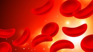 Sickle Cell Anemia [upl. by Akir]