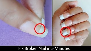 FIX BROKEN NAIL IN 5 MINUTE WITHOUT GLUE [upl. by Notsirk]