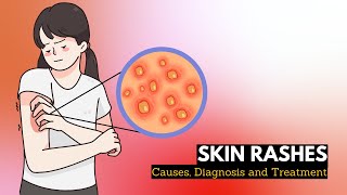 Skin Rash Causes Signs and Symptoms Diagnosis and Treatment [upl. by Caitlin]