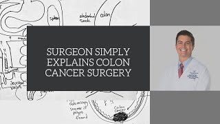 Radiation Treatment How is Radiation Treatment Given [upl. by Burns215]