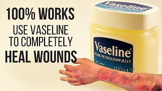 100 WORKS USE VASELINE TO COMPLETELY HEAL WOUNDS [upl. by Ricarda]