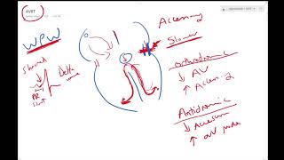 Atrioventricular reentrant tachycardia  Dr Jamal  ECG Lectures [upl. by Aydne]