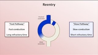 Intro to EKG Interpretation  Mechanisms of Tachyarrhythmias [upl. by Uchida]