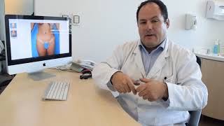 ¿Cuánto demora la recuperación de una abdominoplastia [upl. by Avid311]