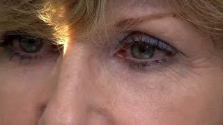 Common Eye Symptoms Part 2 Eye Discharge Red Eyes Itchy Eyes amp Pain in the Eyes [upl. by Indihar]