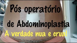 Pós operatório de Abdominoplastia lipoaspiração e enxerto de glúteo  dicas [upl. by Nemajneb]