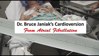 Dr Bruce Janiaks Cardioversion from Atrial Fibrillation [upl. by Ahsiryt]