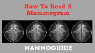 How To Read A Mammogram [upl. by Edwine]