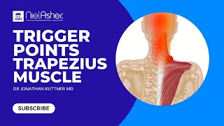 Trapezius  How To Find Trigger Points [upl. by Afrika]