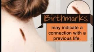 Are Birthmarks Related to Our Past Life Experiences [upl. by Corney160]