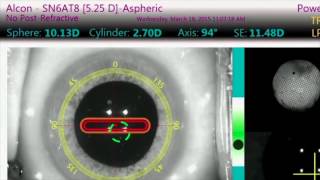 ASMR Peripheral Vision Tests  Eye Exam visual triggers [upl. by Llewen942]