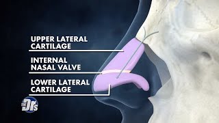 Nasal Polyps Frequency Sinus Frequency Sinus Healing Frequency [upl. by Aihsile]