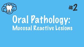 Oral Pathology  Mucosal Reactive Lesions  INBDE ADAT [upl. by Bak322]