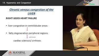 Hyperemia amp Congestion [upl. by Novhaj]