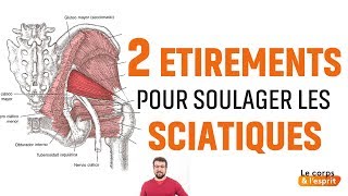 LES SCIATIQUES  Douleurs Bas du Dos Causes  Episode 7bis [upl. by Sela]