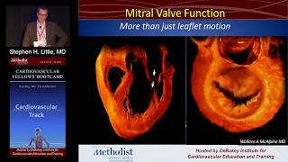 Mitral Valve Stenosis Diagnosis Treatment Pathophysiology [upl. by Ramos]