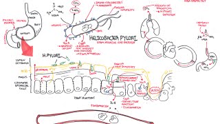 Microbiology  Helicobacter Pylori Ulcer [upl. by Kahn393]