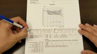 How to Read Your Hearing Test [upl. by Llehsyar]