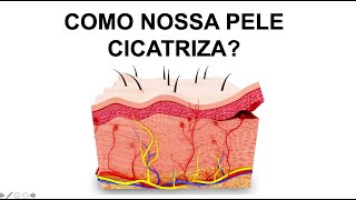 COMO OCORRE A CICATRIZAÇÃO NA PELE Por Luiz Gameiro dermatologista [upl. by Gertrude]